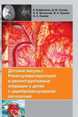 Детский инсульт. Реваскуляризирующие и реконструктивные операции у детей с цереброваскулярной патологией - Коллектив авторов